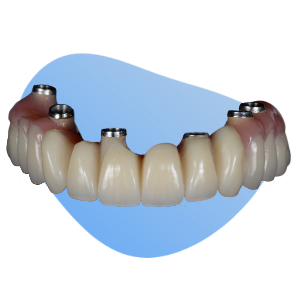 An image of a dental implant with a blue background.