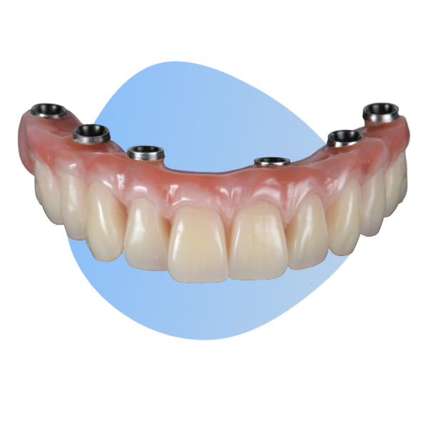 An image of a dental implant with a blue background.