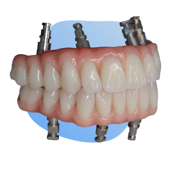 A model of a dental implant with a blue background.