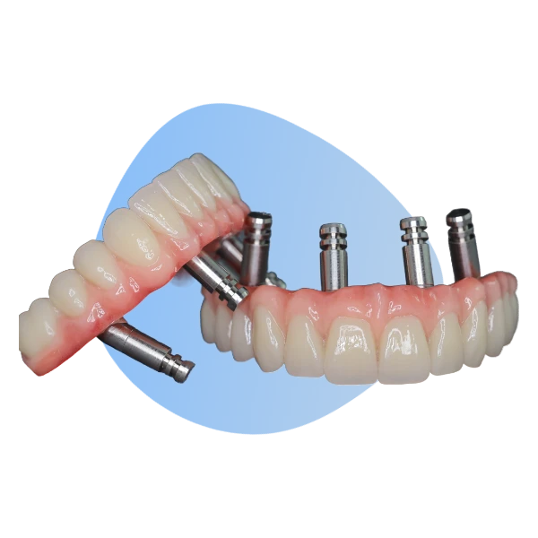 A set of dental implants with a blue background.